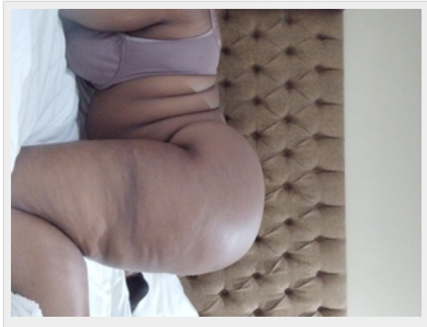 Missing Profile Picture