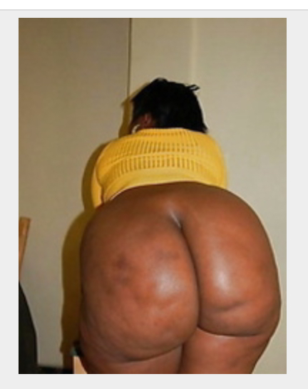 Missing Profile Picture