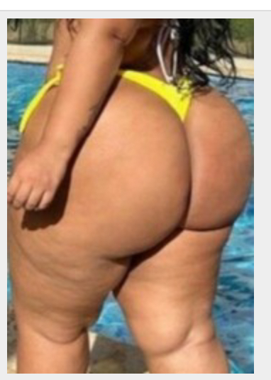 Missing Profile Picture