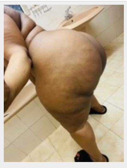 Missing Profile Picture