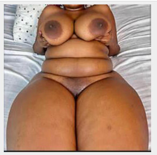 Missing Profile Picture