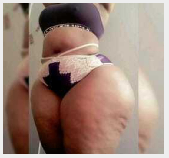 Missing Profile Picture